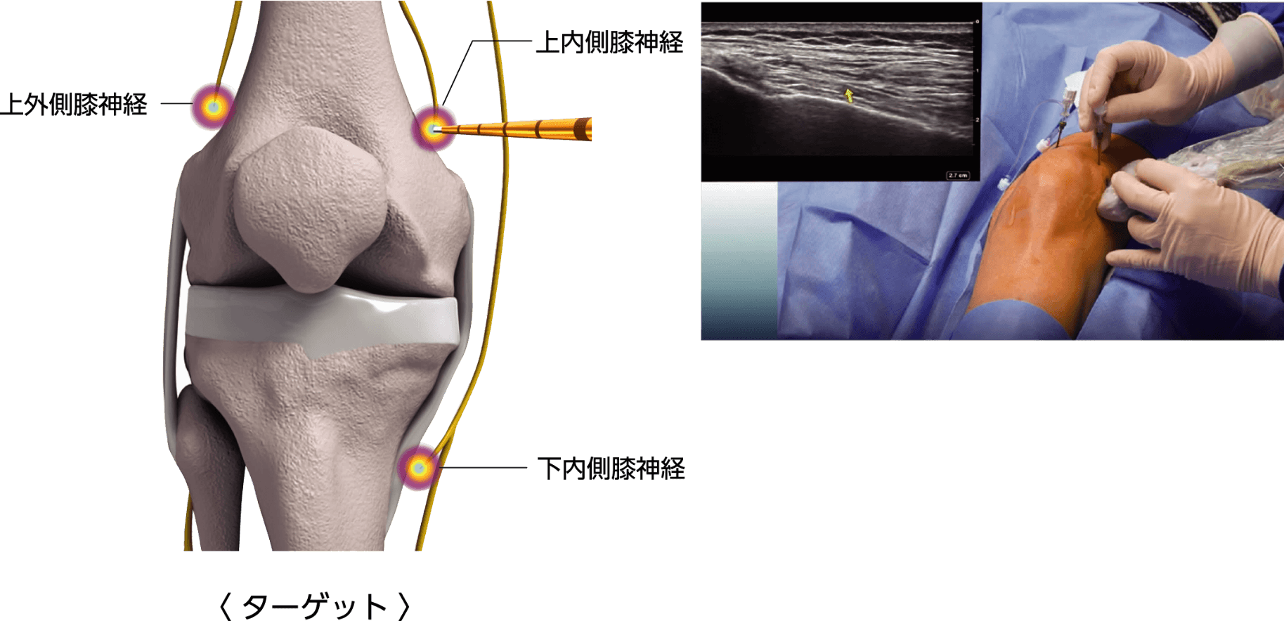 クーリーフ治療について